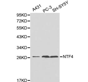 Anti-NTF4 Antibody from Bioworld Technology (BS6135) - Antibodies.com