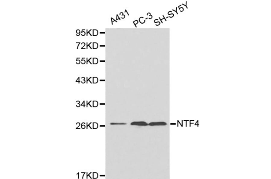 Anti-NTF4 Antibody from Bioworld Technology (BS6135) - Antibodies.com