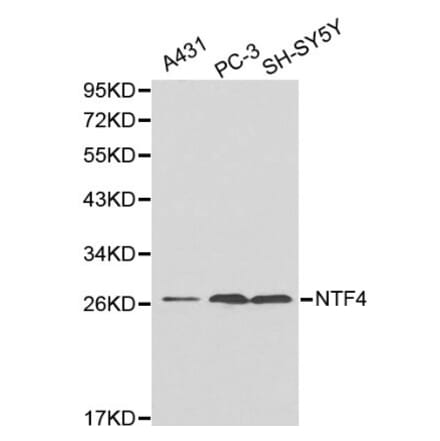 Anti-NTF4 Antibody from Bioworld Technology (BS6135) - Antibodies.com