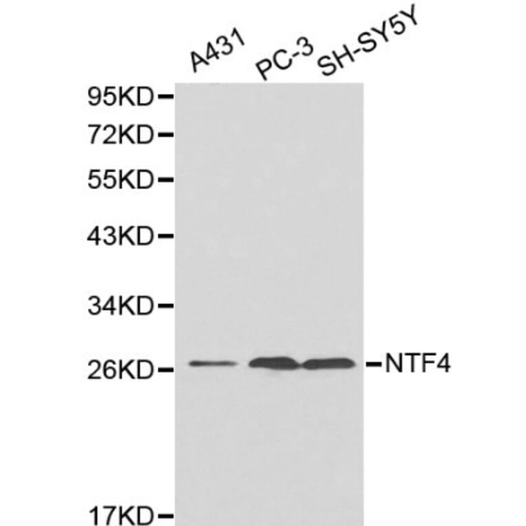 Anti-NTF4 Antibody from Bioworld Technology (BS6135) - Antibodies.com