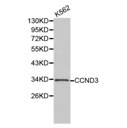 Anti-Cyclin D3 Antibody from Bioworld Technology (BS6139) - Antibodies.com