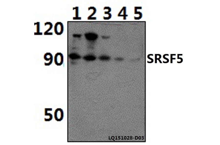 Anti-SRSF5 Antibody from Bioworld Technology (BS61390) - Antibodies.com
