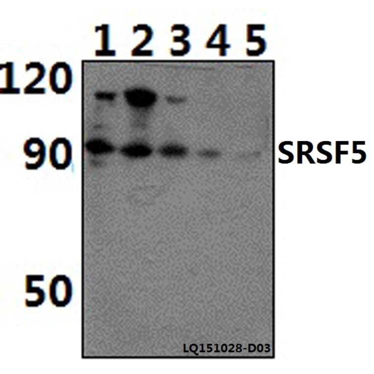 Anti-SRSF5 Antibody from Bioworld Technology (BS61390) - Antibodies.com