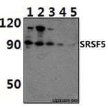 Anti-SRSF5 Antibody from Bioworld Technology (BS61390) - Antibodies.com