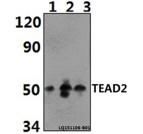 Anti-TEAD2 Antibody from Bioworld Technology (BS61393) - Antibodies.com