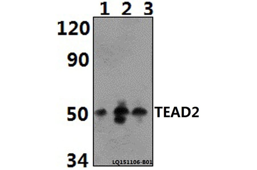 Anti-TEAD2 Antibody from Bioworld Technology (BS61393) - Antibodies.com