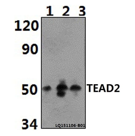 Anti-TEAD2 Antibody from Bioworld Technology (BS61393) - Antibodies.com