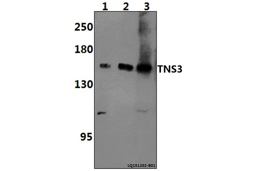 Anti-TNS3 Antibody from Bioworld Technology (BS61397) - Antibodies.com