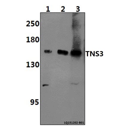 Anti-TNS3 Antibody from Bioworld Technology (BS61397) - Antibodies.com