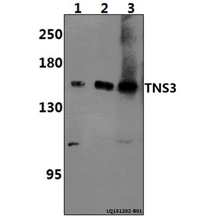 Anti-TNS3 Antibody from Bioworld Technology (BS61397) - Antibodies.com