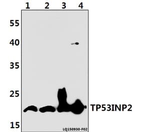 Anti-TP53INP2 Antibody from Bioworld Technology (BS61399) - Antibodies.com