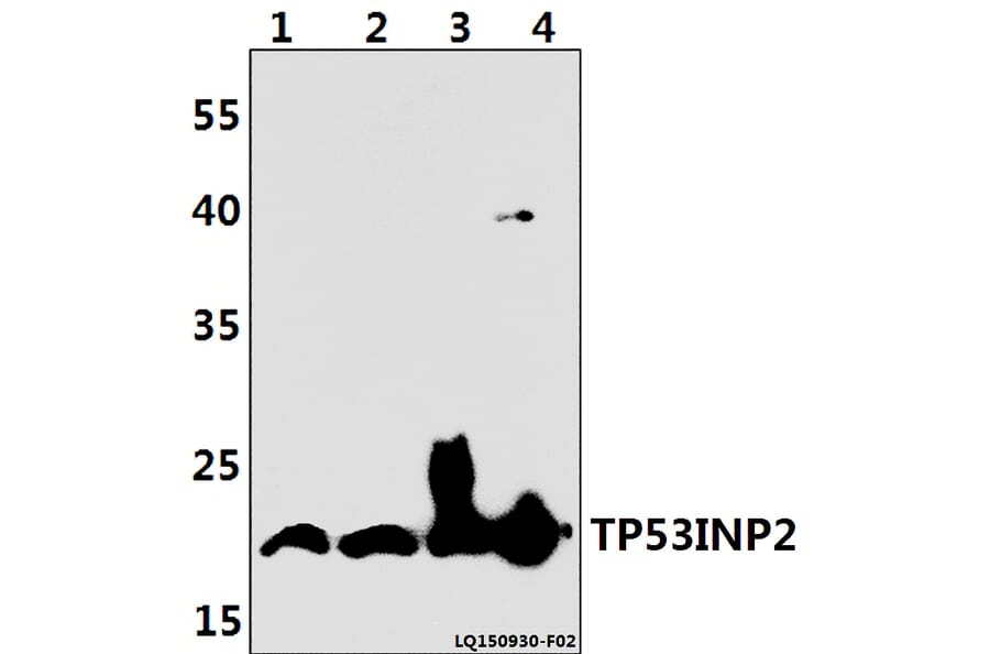 Anti-TP53INP2 Antibody from Bioworld Technology (BS61399) - Antibodies.com