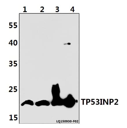 Anti-TP53INP2 Antibody from Bioworld Technology (BS61399) - Antibodies.com