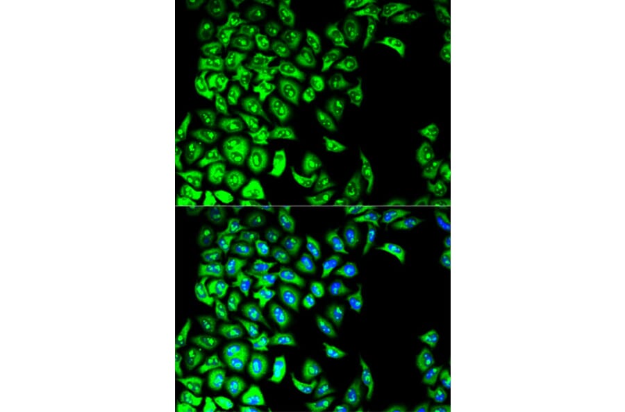 Anti-PDIA3 Antibody from Bioworld Technology (BS6140) - Antibodies.com