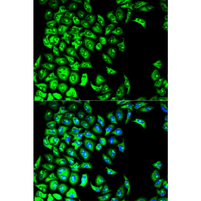 Anti-PDIA3 Antibody from Bioworld Technology (BS6140) - Antibodies.com