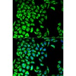 Anti-PDIA3 Antibody from Bioworld Technology (BS6140) - Antibodies.com