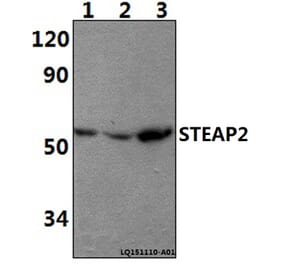 Anti-STEAP2 Antibody from Bioworld Technology (BS61401) - Antibodies.com