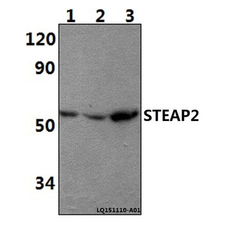 Anti-STEAP2 Antibody from Bioworld Technology (BS61401) - Antibodies.com