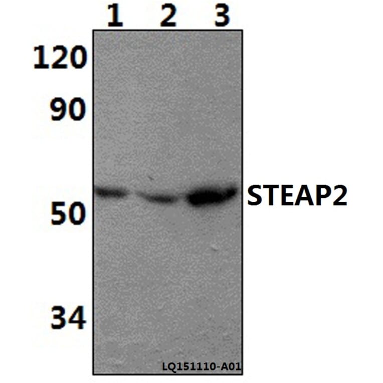 Anti-STEAP2 Antibody from Bioworld Technology (BS61401) - Antibodies.com