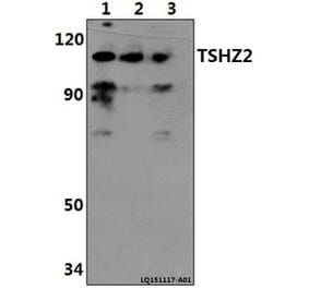Anti-TSHZ2 Antibody from Bioworld Technology (BS61409) - Antibodies.com