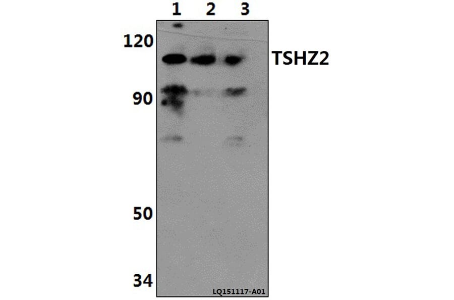 Anti-TSHZ2 Antibody from Bioworld Technology (BS61409) - Antibodies.com