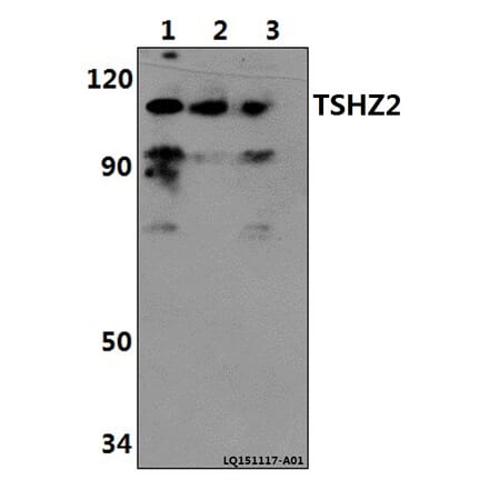 Anti-TSHZ2 Antibody from Bioworld Technology (BS61409) - Antibodies.com
