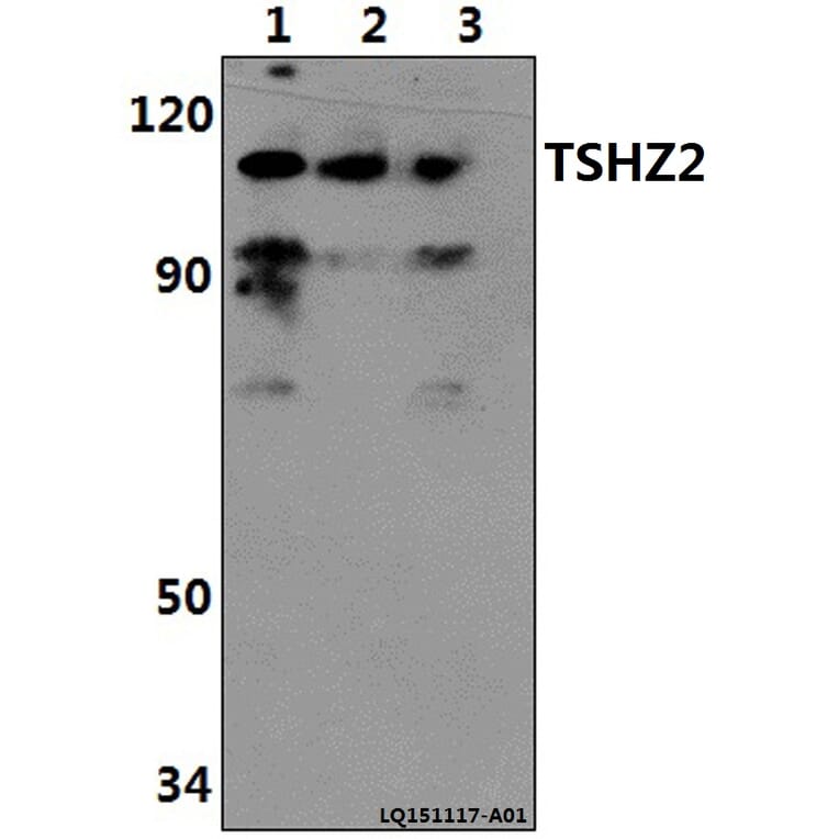 Anti-TSHZ2 Antibody from Bioworld Technology (BS61409) - Antibodies.com