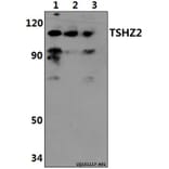 Anti-TSHZ2 Antibody from Bioworld Technology (BS61409) - Antibodies.com
