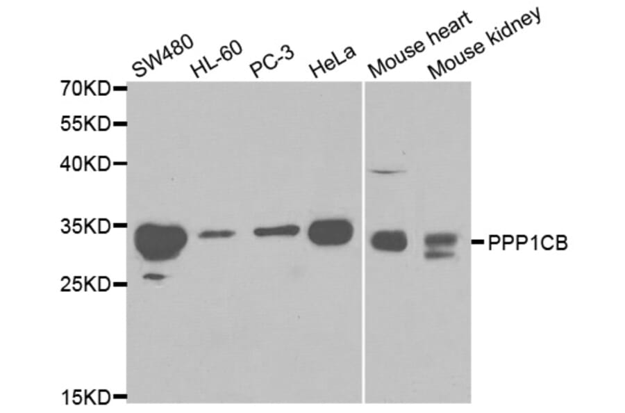 Anti-PPP1CB Antibody from Bioworld Technology (BS6143) - Antibodies.com