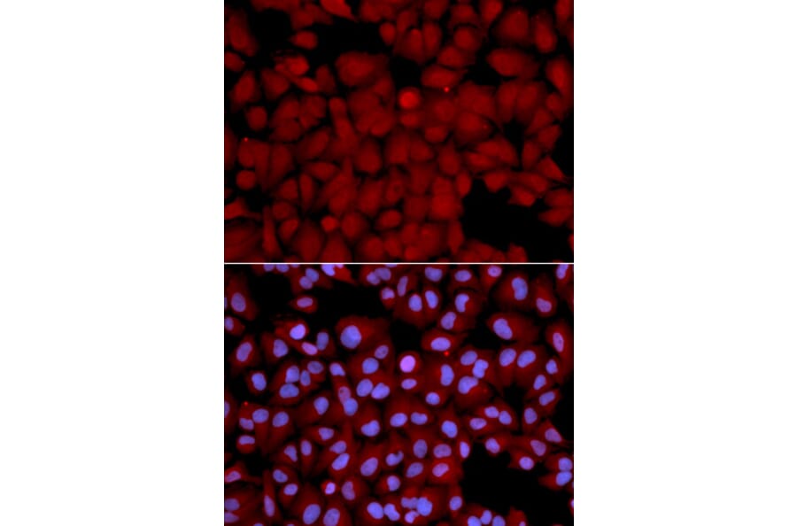 Anti-PPP1CB Antibody from Bioworld Technology (BS6143) - Antibodies.com