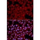 Anti-PPP1CB Antibody from Bioworld Technology (BS6143) - Antibodies.com