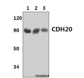 Anti-CDH20 Antibody from Bioworld Technology (BS61431) - Antibodies.com