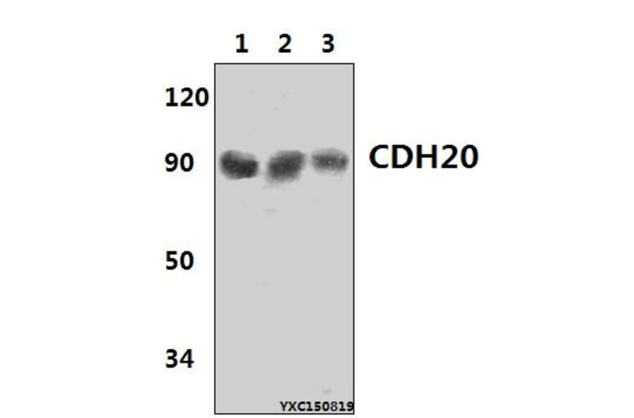 Anti-CDH20 Antibody from Bioworld Technology (BS61431) - Antibodies.com