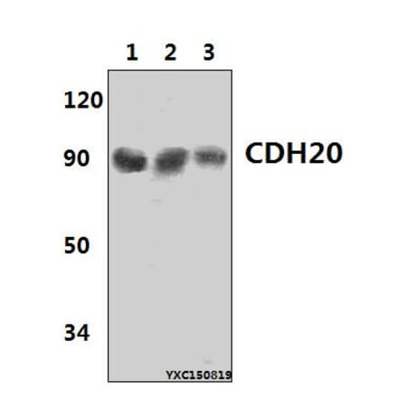 Anti-CDH20 Antibody from Bioworld Technology (BS61431) - Antibodies.com