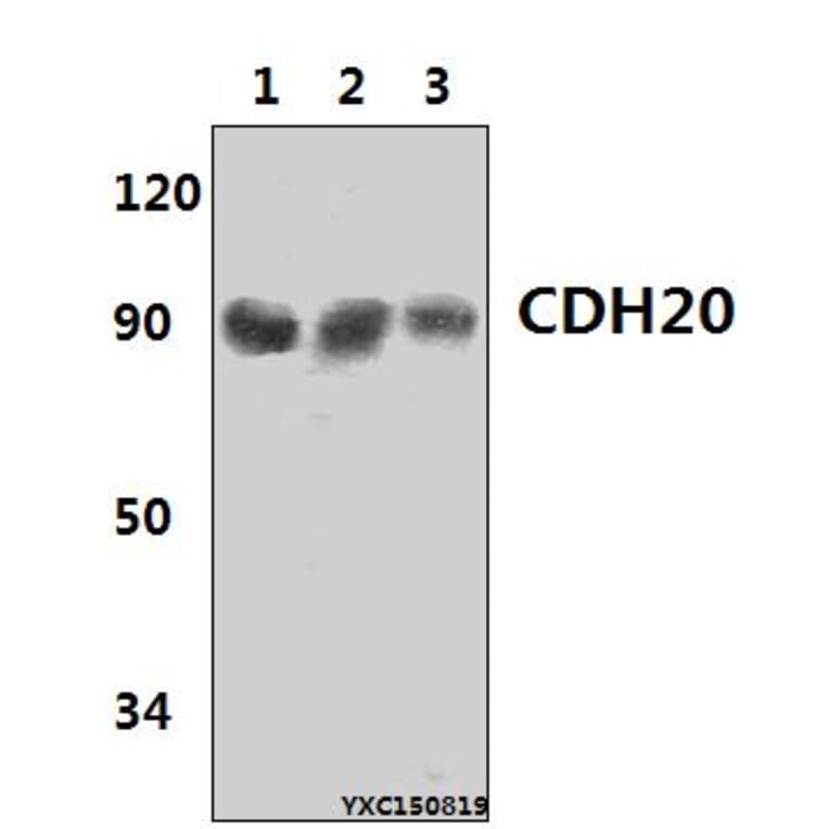 Anti-CDH20 Antibody from Bioworld Technology (BS61431) - Antibodies.com