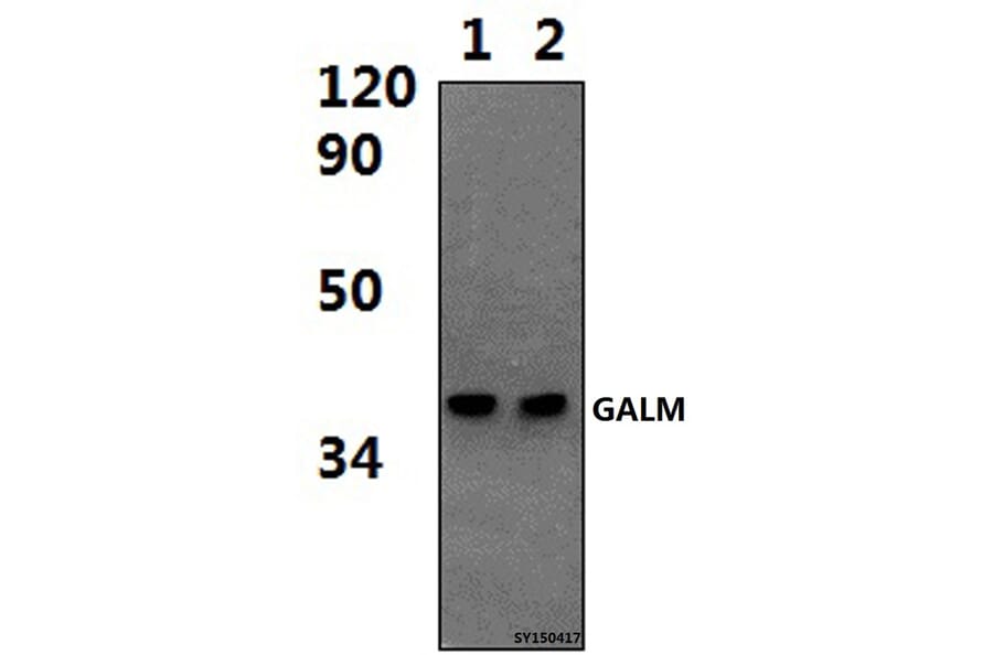 Anti-GALM Antibody from Bioworld Technology (BS61444) - Antibodies.com