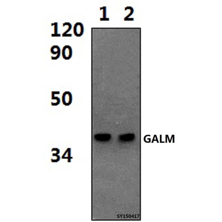 Anti-GALM Antibody from Bioworld Technology (BS61444) - Antibodies.com