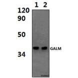 Anti-GALM Antibody from Bioworld Technology (BS61444) - Antibodies.com