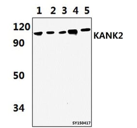 Anti-KANK2 Antibody from Bioworld Technology (BS61445) - Antibodies.com