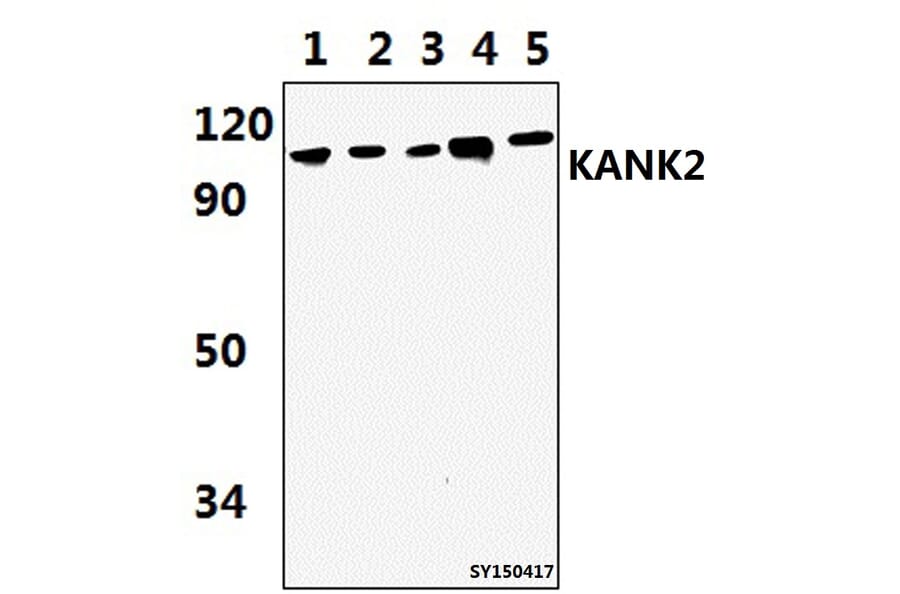Anti-KANK2 Antibody from Bioworld Technology (BS61445) - Antibodies.com