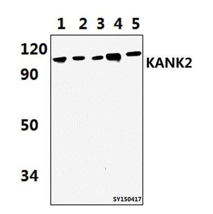 Anti-KANK2 Antibody from Bioworld Technology (BS61445) - Antibodies.com