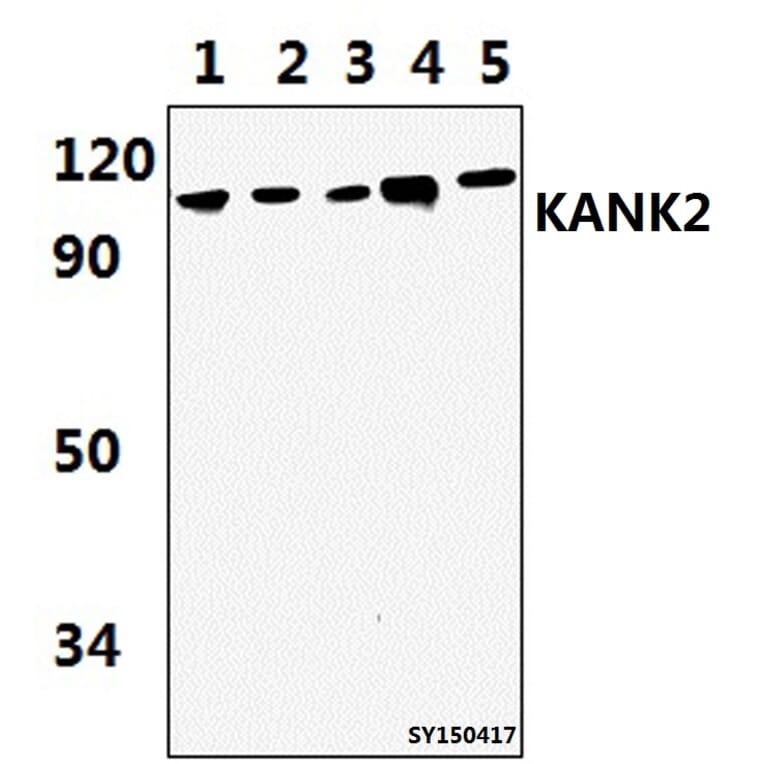 Anti-KANK2 Antibody from Bioworld Technology (BS61445) - Antibodies.com