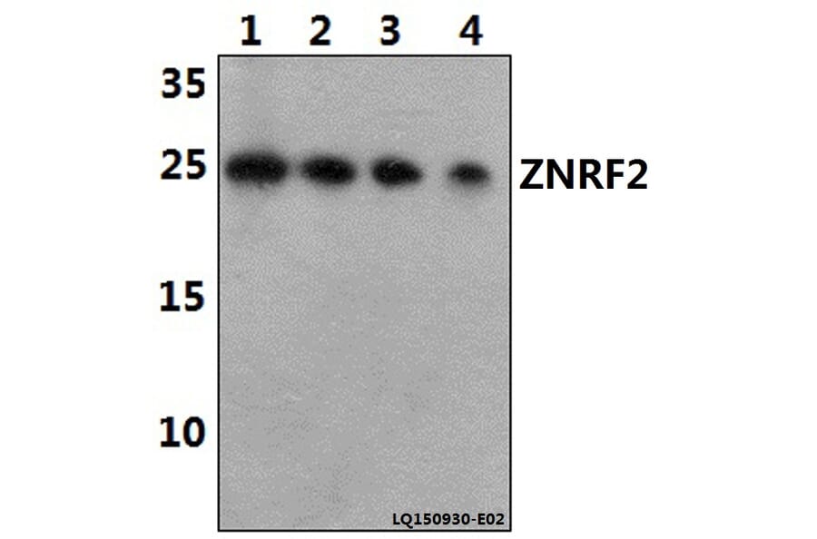 Anti-ZNRF2 Antibody from Bioworld Technology (BS61455) - Antibodies.com