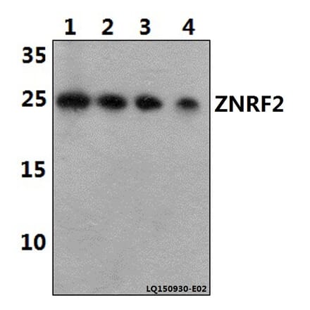 Anti-ZNRF2 Antibody from Bioworld Technology (BS61455) - Antibodies.com