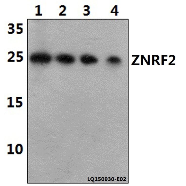 Anti-ZNRF2 Antibody from Bioworld Technology (BS61455) - Antibodies.com