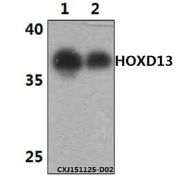 Anti-HOXD13 Antibody from Bioworld Technology (BS61458) - Antibodies.com