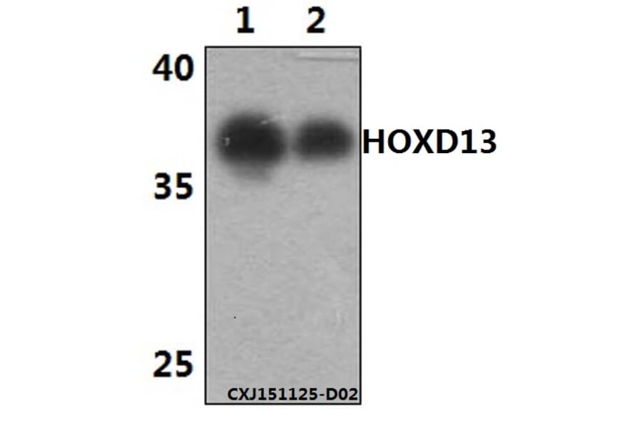 Anti-HOXD13 Antibody from Bioworld Technology (BS61458) - Antibodies.com