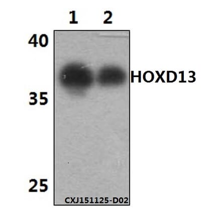 Anti-HOXD13 Antibody from Bioworld Technology (BS61458) - Antibodies.com