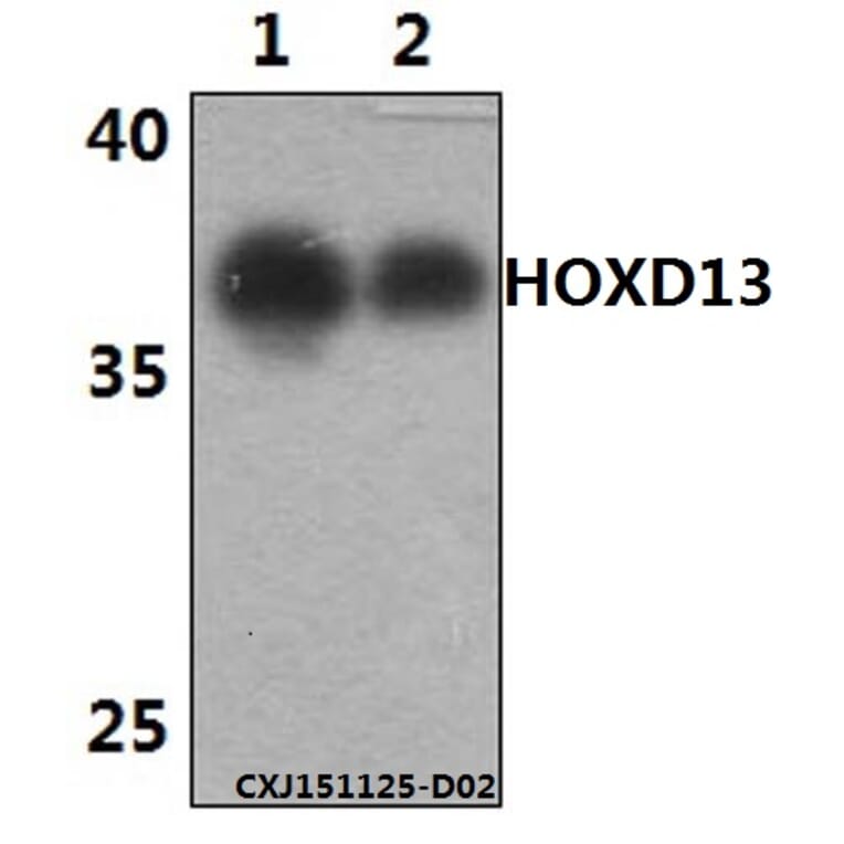 Anti-HOXD13 Antibody from Bioworld Technology (BS61458) - Antibodies.com