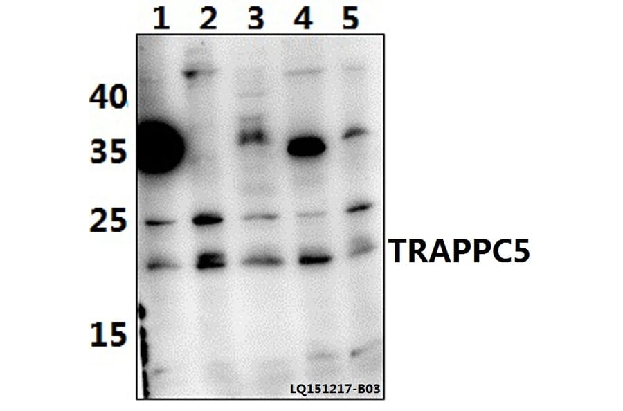 Anti-TRAPPC5 Antibody from Bioworld Technology (BS61465) - Antibodies.com